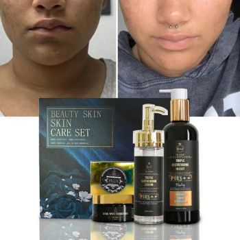 Glutathione Collagen Whitening Skin Care Set Strong Effective Anti Acne Dark Spot Cream Serum Oil Set Brightening Skin Care Set - Guangzhou E-Mei Biotechnology Co., Ltd. - China