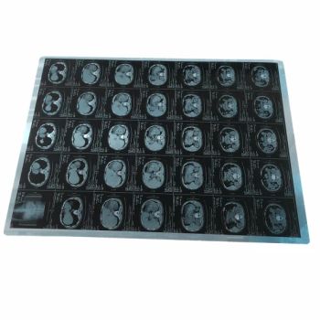 Blue Color 180 Micron 10X12 Inch Digital X Ray Films for Agfa Drystar 5302 - LeYiDi International Medical Devices (Beijing) Co., Ltd. - China