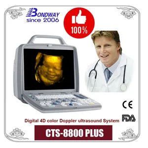 Portable Color Doppler Diagnostic Ultrasound, Mobile 4D Baby Ultrasound, Pregnancy Scanner Ultrasound - Shenzhen Bondway Electronics Co., Ltd. - China