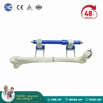 Xc Medico Orthopedic Medical Device Bone Fixation Tibia and Femur External Fixator - Xc Technology Co., Ltd. - China