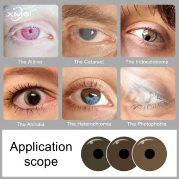 Prosthetic Contact Lenses for People with Eye Defects Glaucoma Eye Iris Color Blind Contact Lenses - Changzhou X-Mei Optical Technology Co., Ltd. - China