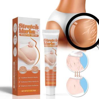 Best Seller Stretch Mark Removal Cream Pregnant Postpartum Laxity Scar Ointment Belly Whitening Smooth Repair Product - Yangzhou Holly International Co., Ltd. - China