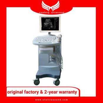 Trolley Black and White Ultrasound Machines Medical Equipments - Mianyang Xianfeng Medical Instrument Co., Ltd. - China
