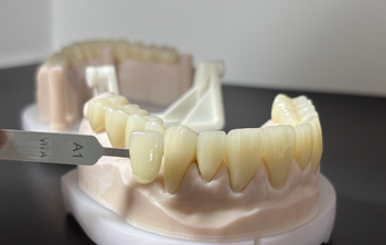 Myy Dental Lab - Implants, Provisional, Dentures, Crowns - Shenzhen Myy Dental Technology Co., Ltd. - China