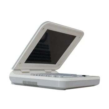 U10 Mini Portable Laptop Black and White Sonography Equipment - Somatech Medical Co., Ltd. - China