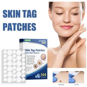 Fast & Improved Formula Skin Tag Remover Patches for Face and Body - Tian Yi Technology (Shen Zhen) Company Limited - China