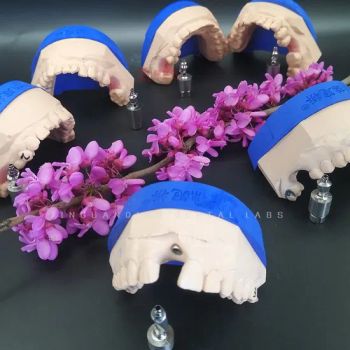 Dental Implant Crowns and Bridges Ensure a Predictable Result, Esthetic Gingival Margins and a Natural Emergence Profile - Guangzhou Jinguanqiao Industry Co., Ltd. - China
