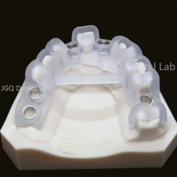 Dental Lab Customize Quality Implant Surgical Guide Wholesale Cheap Price - Guangzhou Jinguanqiao Industry Co., Ltd. - China