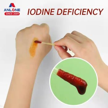 Premium Povidone Iodine Filled Cotton Swab Medical Cleaning Disposable - Qingdao Anlone Biotechnology Co., Ltd. - China