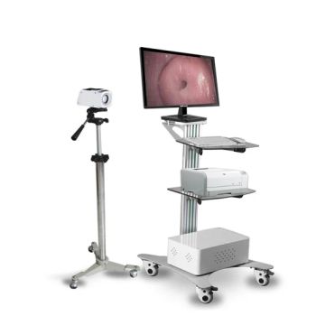 Ocp3302 Medical Diagnosis Digital Gynecology Optical High-Teach Electronic Mobile Equipment Colposcopey Digital Video Colposcope - Chongqing Vision Star Optical Co., Ltd. - China