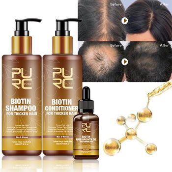 Private Label Organic Biotin Hair Growth Shampoo and Conditioner Set Natural Herbal Thickening Anti Hair Loss Shampoo from EcoRoma GmbH Private Label Organic Biotin Hair Growth Shampoo and Conditioner Set Natural Herbal Thickening Anti Hair Loss Shampoo - EcoRoma GmbH - Germany