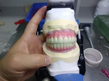 Dental Lab Factory in China OEM Dental Lab Manufacturer from China - Shenzhen Myy Dental Technology Co., Ltd. - China