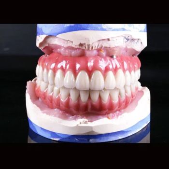 Implanted Dentures China Dental Lab Custom Made Zirconia Implant Bridges and Crowns Factory Price Implanted Teeth - Guangzhou Jinguanqiao Industry Co., Ltd. - China