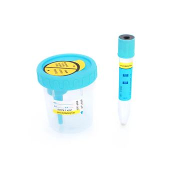 Wholesale Urine Sample Test Specimen Collection Cup Medical Plastic Disposable Sterile Stool Urine Container 120ml - Beijing Hanbaihan Medical Devices Co., Ltd. - China