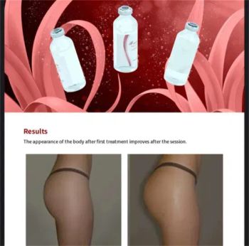 B-Esta New Body Breast Buttock Enhancement Ha Dermal Filler Injection Plastic Surgery Implants Size Hyaluronic Acid Gel B-Esta Body Filler 50ml 50cc - Shijiazhuang Langland Technology Co., Ltd. - China