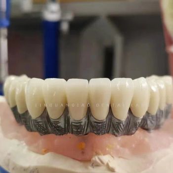 Factory Price Dental Lab Products Implant Dentures for Edentulous Jaw - Guangzhou Jinguanqiao Industry Co., Ltd. - China