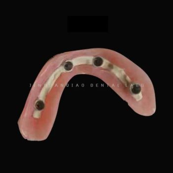 Full Mouth Implant Dentures All-on-X Dental Implant Surgical Guide Support - Guangzhou Jinguanqiao Industry Co., Ltd. - China