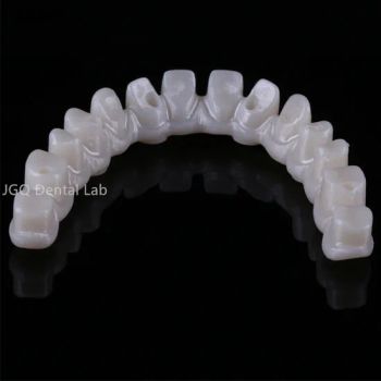 Dental Implant Hybrid Full Jaw Screwed Zirconium Crowns and Bridge From China - Guangzhou Jinguanqiao Industry Co., Ltd. - China