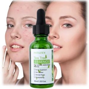 Brightening Green Tea Tree Anti Acne Serum Whitening Hydrating Skincare Facial Essence - Guangzhou Guocui Biological Technology Co., Ltd. - China