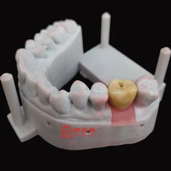 Quick Turnaround for Your Clinic Dental Orders China-Made Dental Implants Affordable and Durable - Guangzhou Jinguanqiao Industry Co., Ltd. - China
