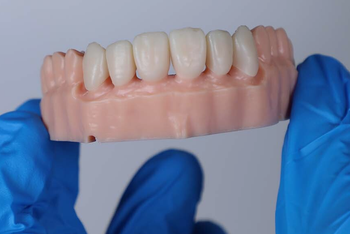 Dental Lab Direct Digital Full Denture China Dental Outsourcing - Shenzhen Myy Dental Technology Co., Ltd. - China