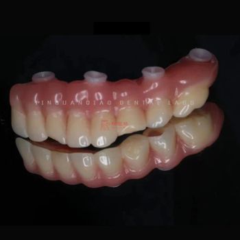 Dental Surgical Guide for Implant Restoration Full Arch Implant Dentures China Dental Lab - Guangzhou Jinguanqiao Industry Co., Ltd. - China