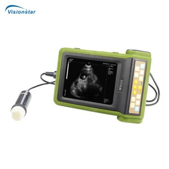 Msu-2 Full Digital Mechanical Sector Ultrasonic Diagnostic Instrument (Veterinary) - Chongqing Vision Star Optical Co., Ltd. - China