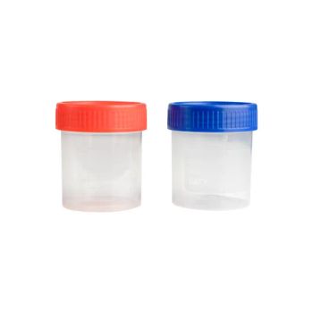 Medical Supplies Disposable 40ml Specimen Urine Container - Chongqing New World Trading Co., Ltd. - China