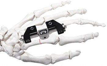 Adjustable External Fixator in White & Black, for Bone Fixation, Titanium Alloy - Suzhou Youbetter Medical Apparatus Co., Ltd. - China