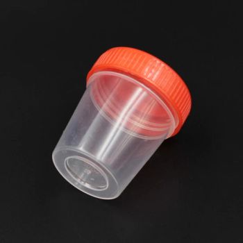 Disposable 40ml Sterile Medical Specimen Collection Sample Urine Cups Container Products - Ningbo Yingmed Medical Instruments Co., Ltd. - China