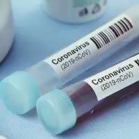 Covid -19 Test Kits -  Cong Ty Tnhh Dich Vu Co Ho  - Vietnam