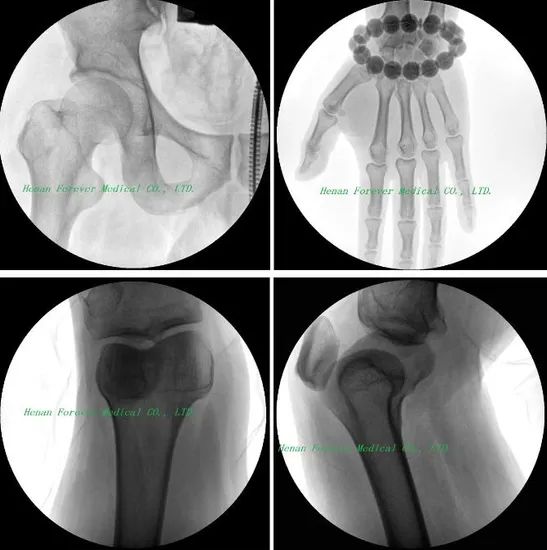 C-Arm Large Rotation System Trauma Surgery Digital X-ray Camera - Image 6