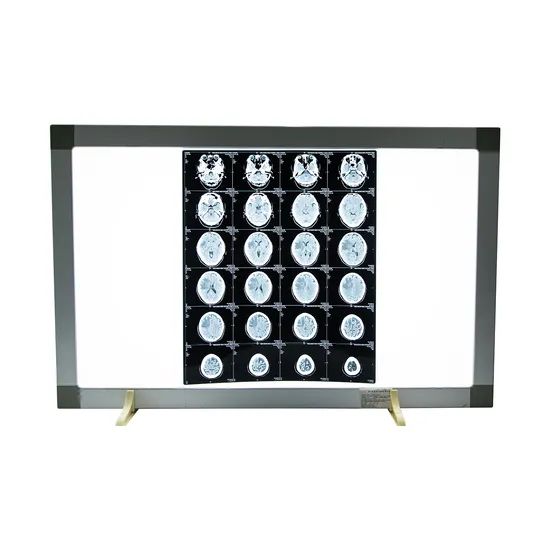 Pvc Radiography Precision Clear Imaging Money-Saving Medical Dry Radiography X Ray PVC ...