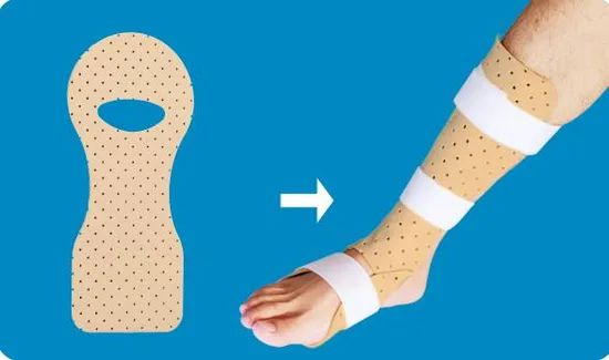 Drop Foot Splint Prosthetics & Orthopaedics Low Temperature Thermoplastics - Image 1