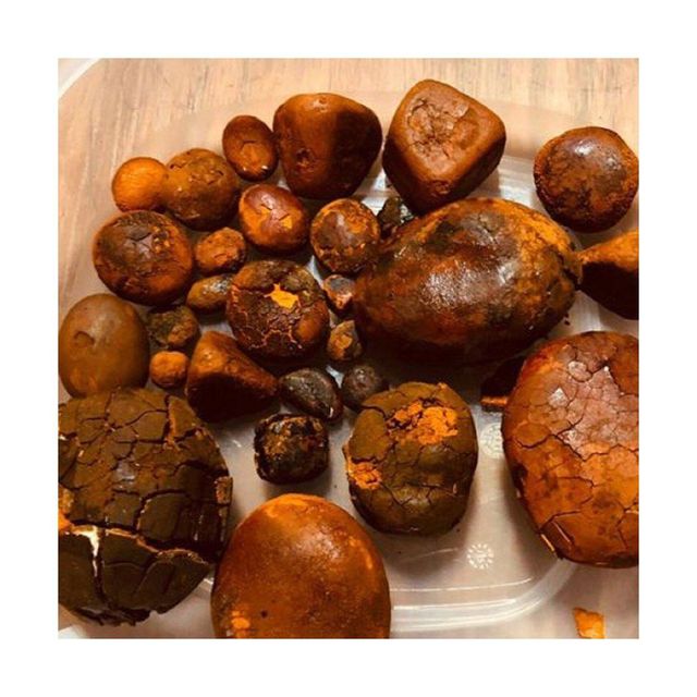 Top-Grade Cow Gallstones  100% Organic & Sun-Dried - Image 3