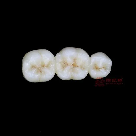 Customized Remote All Ceramic Teeth Supports Browsing Files in Various Formats Stl Ply Dcm Impression Model - Image 6