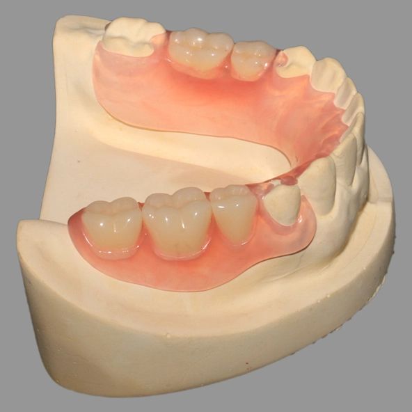 China dental labs  china dental laboratory   chinese dental lab - Image 3