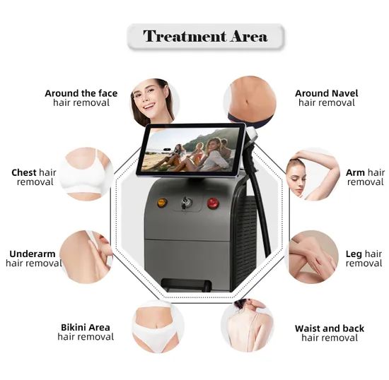 Professional Diode Laser Laser Hair Removal Machine Origin China Portable Portable Model Diode Laser Warranty Two Years Trademark Fosyderm - Image 2