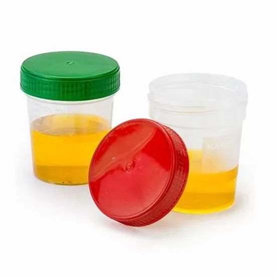 Factory Direct Urine Container Test Container Urine Cup Specimen Container - Image 2