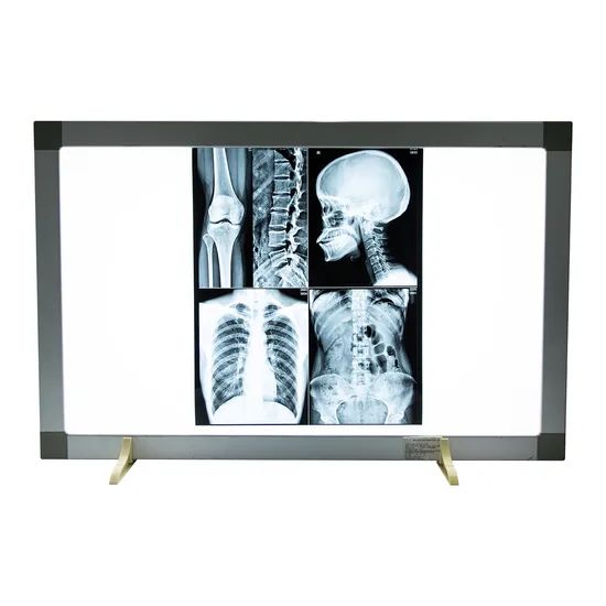 Pvc Radiography Precision Clear Imaging Money-Saving Medical Dry Radiography X Ray PVC ...