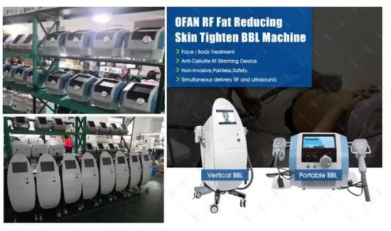 Ofan Eye Bag Removal Ultrasound Fat Reducing RF Equipment Skin Tighten Beauty Equipment - Image 5