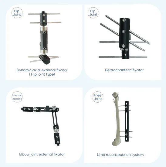 Xc Medico Orthopedic Medical Device Bone Fixation Tibia and Femur External Fixator - Image 5