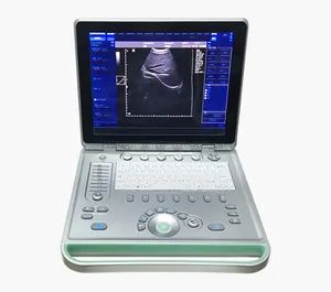 C2 Color Doppler Ultrasound System - Image 4