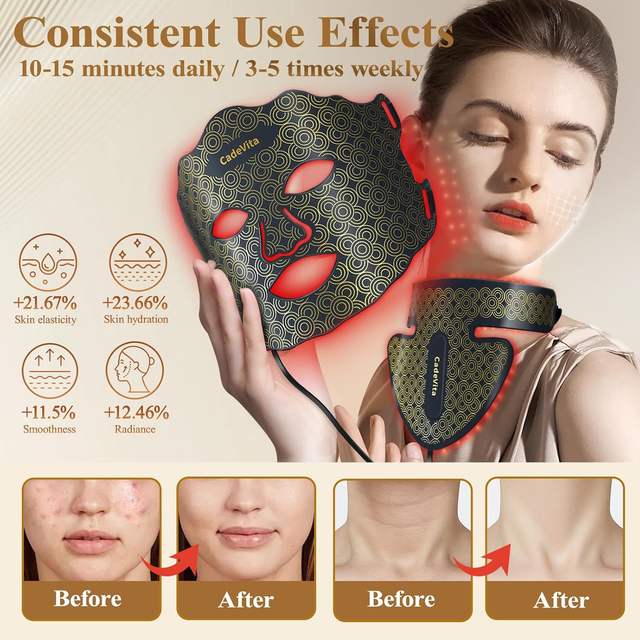 7-Color LED Red Light Therapy Mask for Face & Neck - Rechargeable & Portable - Image 4