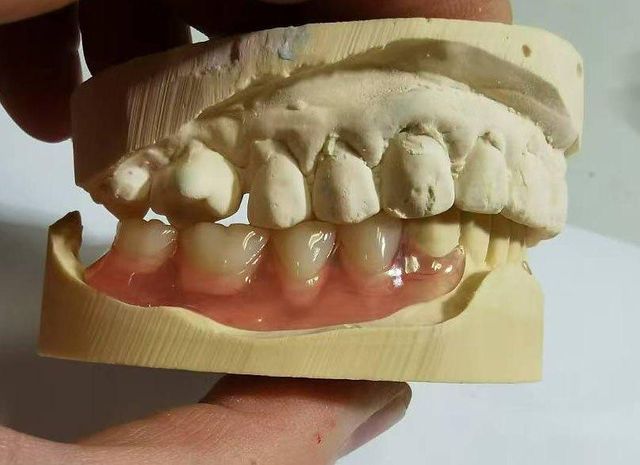 Chinese dental labs Material Glass, Other Packaging Properties Printable - Image 1