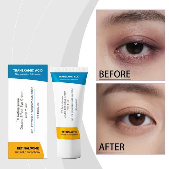 Vegan Retinol Under Eye Cream Collagen Peptides Anti-Aging Eye Cream for Dark Circles Puffiness Wrinkles Fine Lines Eye Cream - Image 5