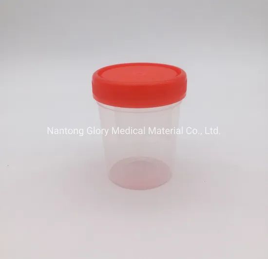 Premium Plastic Specimen Containers for Urine and Stool Samples - Image 3