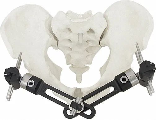 External Fixator for Bone Fixation, White & Black, Titanium Alloy Design - Image 2