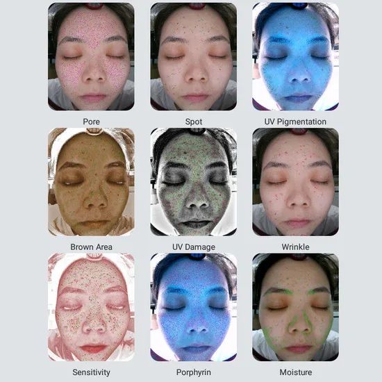 Advanced Ai-Powered Portable Skin Analyzer for Home Use Power 45W Camera HD Model NO. 1 Type Desktop Warranty 1year Model Number Mx - Image 6