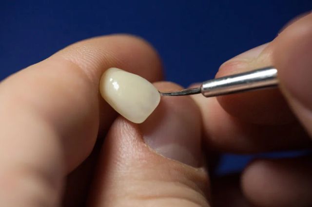 Dental Lab Factory in China OEM Dental Lab Manufacturer from China - Image 3